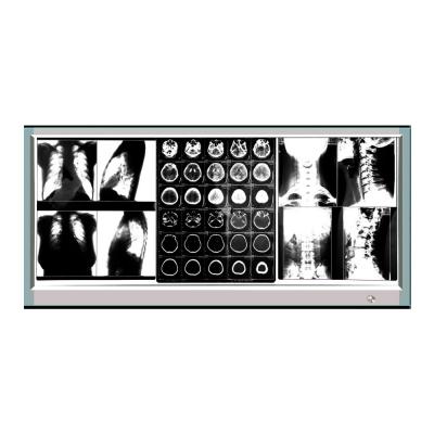 X-ray Film Viewer Box